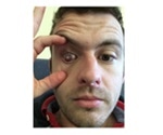 Fight for Sight poll: Brits put their eyesight at risk through unsafe contact lens habits