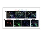 Stem cell stimulation shows promise as potential stroke treatment