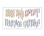 Sleep makes synapses ready for new learning