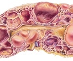 Polycystic kidney disease may be preventable