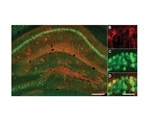 Negative memory hippocampal engrams could underlie cognitive symptoms of depression