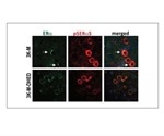 Estrogen could be viable treatment option for Parkinson's patients