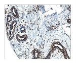 Growth Factor Receptor Signaling for Cancer Research