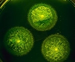 Canadian scientists trap gut microbe fuel to improve blood sugar and liver health
