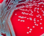 TB bacteria can play dead to outlast the immune response, study reveals