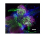 Neuronal gene mutations may be linked to seizures associated with Long QT Syndrome