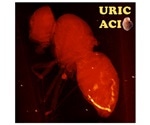 Fruit fly model for studying diseases like gout, kidney stones reveals new drug targets