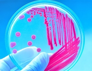 LptM protein revealed as essential to outer membrane stability in bacteria