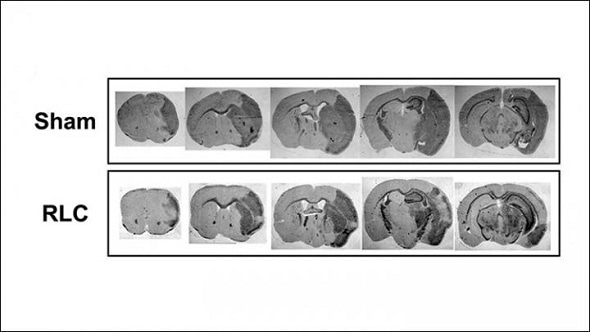 Regulating blood supply to limbs after stroke improves functional recovery