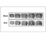 Regulating blood supply to limbs after stroke improves functional recovery