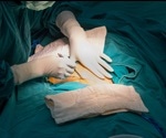Claims that cesarean sections increase the risk of autism are “highly unlikely”, say experts