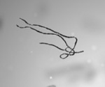 Ebola-Neutralizing Antibodies
