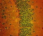 Proteomics of Single Mouse Brain Slices
