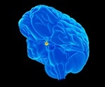 Study uncovers epigenetic origins for hypersexual disorder