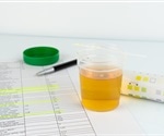 What are Urea Cycle Disorders?