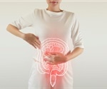 Pyruvate identified as a promising oral treatment for ulcerative colitis