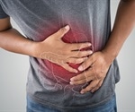 Pyruvate identified as a promising oral treatment for ulcerative colitis