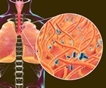 Research shows no association between whooping cough vaccine and asthma