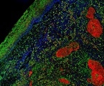 Accelerating Nanobody Production using Polyclonal Anti-VHH Antibodies