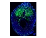 Bone marrow-derived cells also travel to the womb to help pregnancy