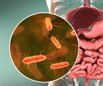 Effects of a Gluten-Free Diet on the Gut Microbiota