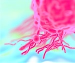 Importance of ER+ Patient Profiling to Determine MBC Therapy Options
