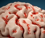 Brain-infecting virus has spread across the US at record rates this year