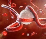 Tanzania keeping Ebola under wraps