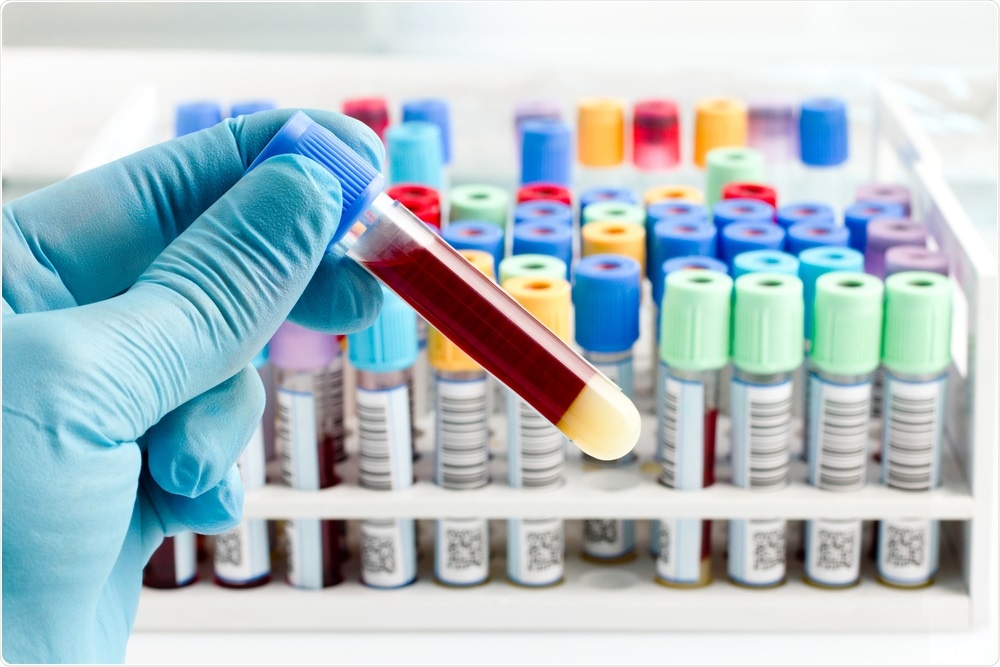 Blood plasma