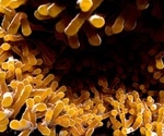 History of Tuberculosis