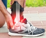 Taking Anabolic Steroids After a Sport Injury