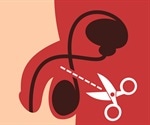 Couple demand an apology over failed vasectomy