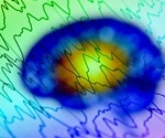 What Happens to the Brain After Death?