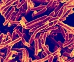 Deadly infection in cystic fibrosis could be curbed with combination medication