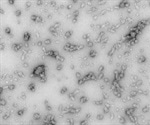 Dopamine Stabilization and Neurodegeneration with Alpha Synuclein Oligomers