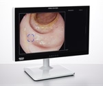 PENTAX Medical secures CE mark approval for innovative AI-assisted polyp detector