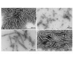 Alpha Synuclein Research Tools for Parkinson's Disease Research