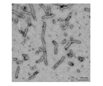 Tau Research Tools for Alzheimer's Disease Research