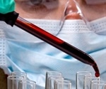 Forensic Identification Made Safer and More Efficient