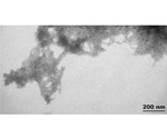 SOD1 Aggregation in Amyloid Lateral Sclerosis