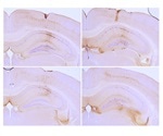 Key Features of Tau Proteins