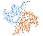How A53T Alpha Synuclein Can Affect Parkinson’s Disease