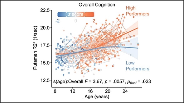 Brain iron needed for healthy cognitive development, research suggests Brain iron needed for healthy cognitive development, research suggests