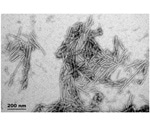 How Neurodegenerative Diseases are Affected by Gamma Synuclein Aggregation