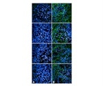 Alzheimer’s Disease and the Role of Tau Phosphorylation