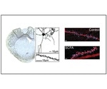 Short chain fatty acid supplementation improves stroke recovery, mice study shows