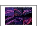 Research suggests a new role for neurogenesis