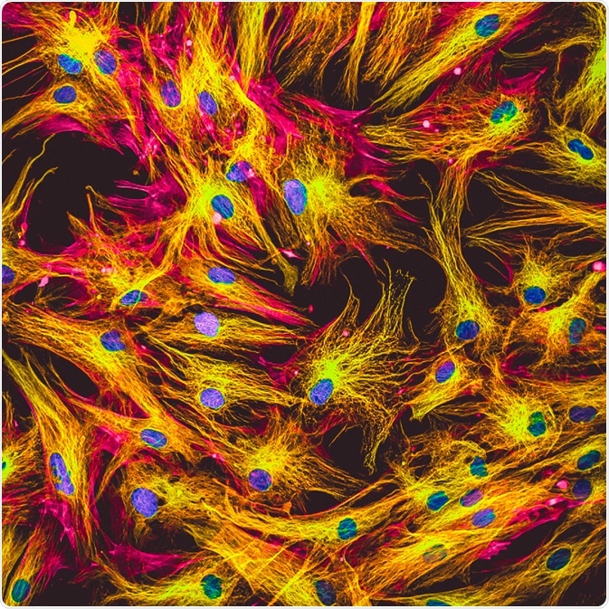Fluorescence Microscopy Fluorescence Microscopy