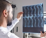 Can an Active Lifestyle Improve Recovery After a Spinal Cord Injury?