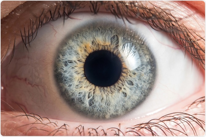 eye cancer